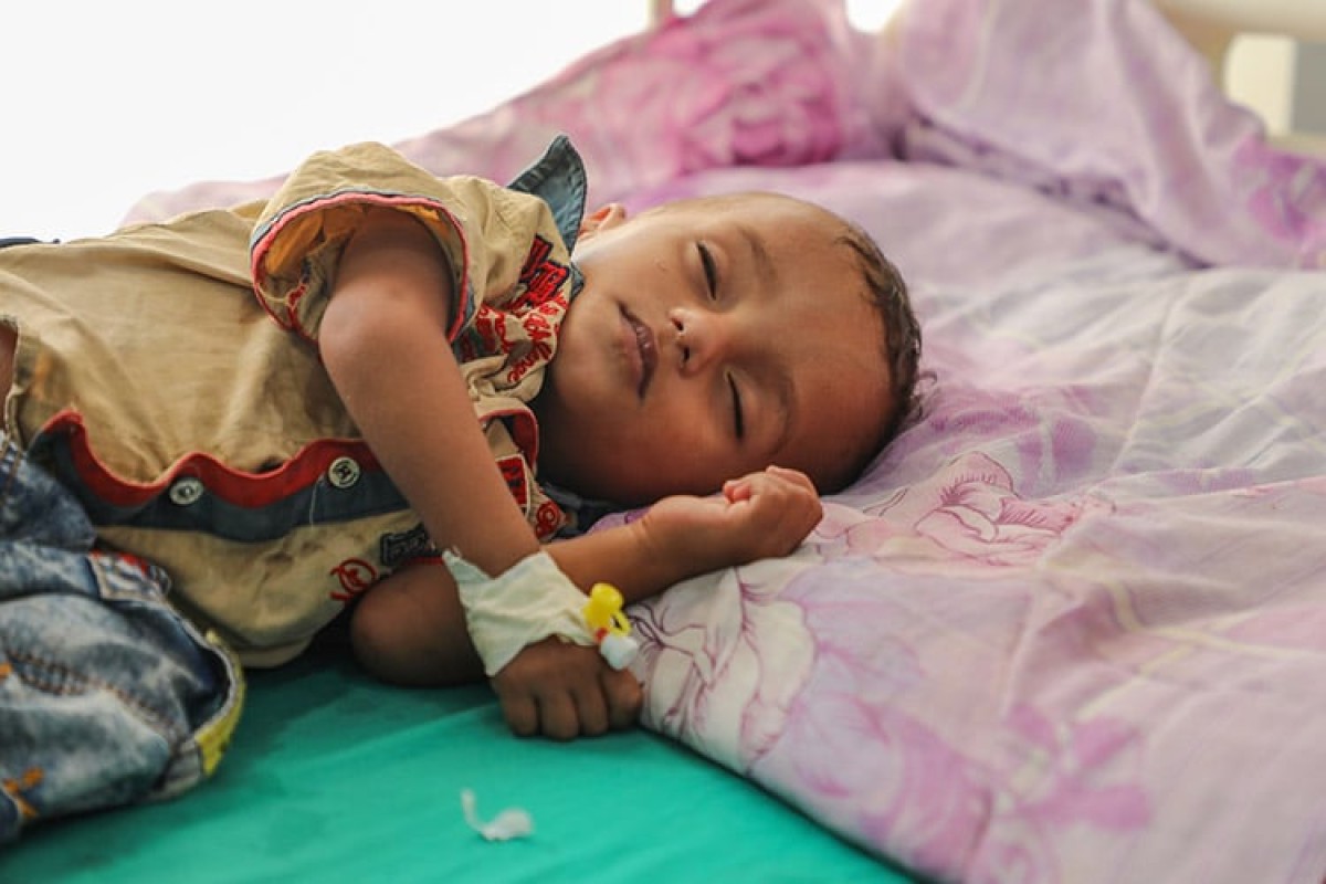 الأغذية العالمي يعلن تعليق برنامج الوقاية من سوء التغذية الحاد في اليمن